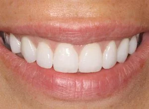 אחרי-ר1-300x219