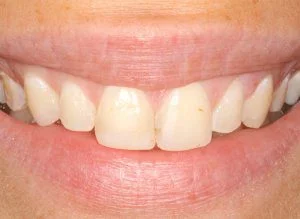 לפני-ר1-300x219