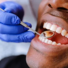 שחיקה חומצית של השיניים (Dental Erosion): כיצד מחלת הרפלוקס פוגעת באמייל ואיך משקמים את החיוך?