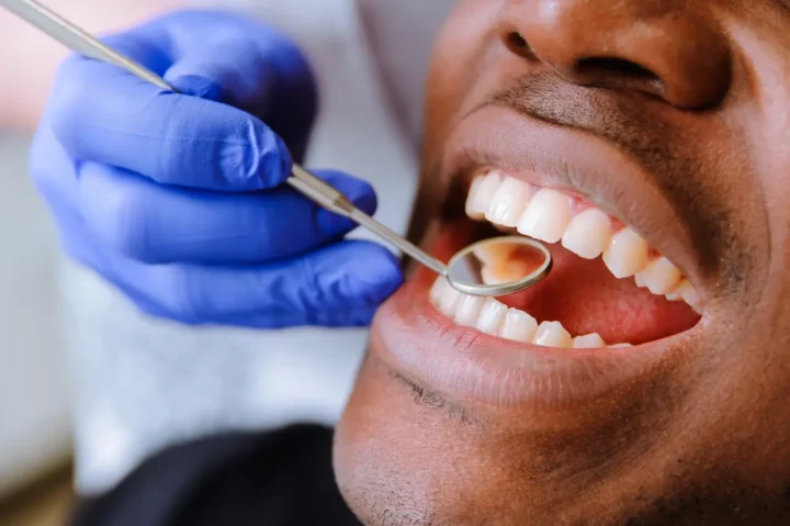 שחיקה חומצית של השיניים (Dental Erosion): כיצד מחלת הרפלוקס פוגעת באמייל ואיך משקמים את החיוך?